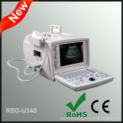 Portable Ultrasonic Diagnostic System in Shenzhen